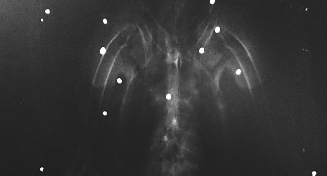 Radiographie de la buse variable